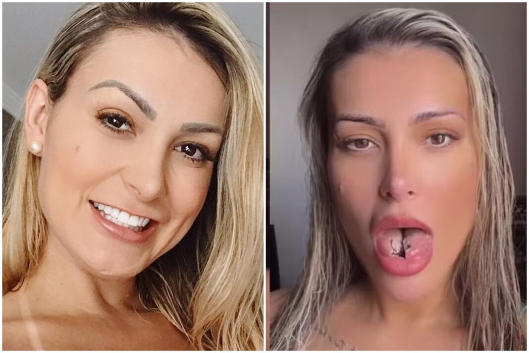 “lingua-de-cobra”:-entenda-o-procedimento-feito-por-andressa-urach