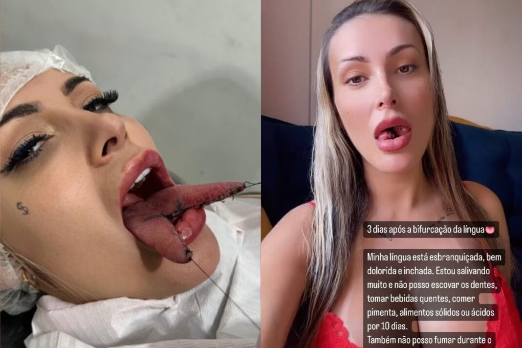 seguidor-manda-andressa-urach-se-tratar-apos-bifurcacao-na-lingua