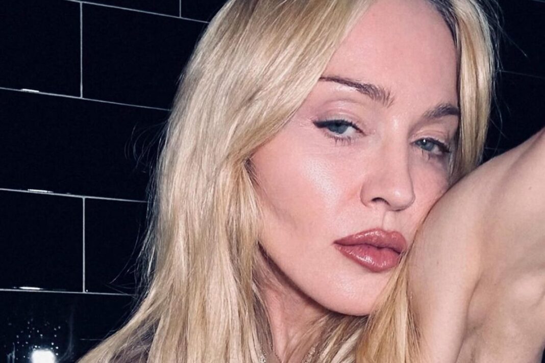 madonna-faz-topless-em-album-de-fotos-com-o-namorado:-veja